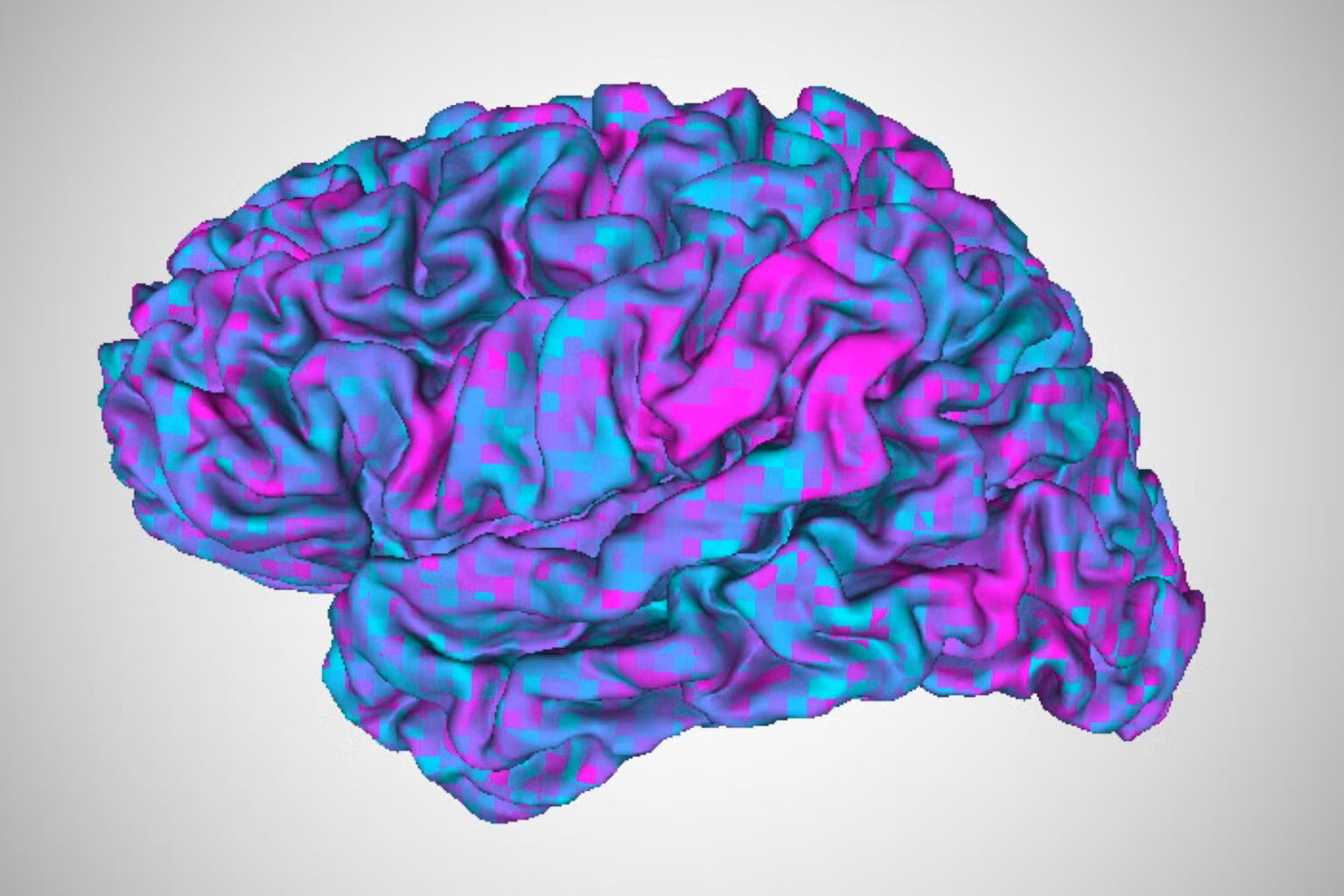 image shows brain activity as measured in an fMRI machine