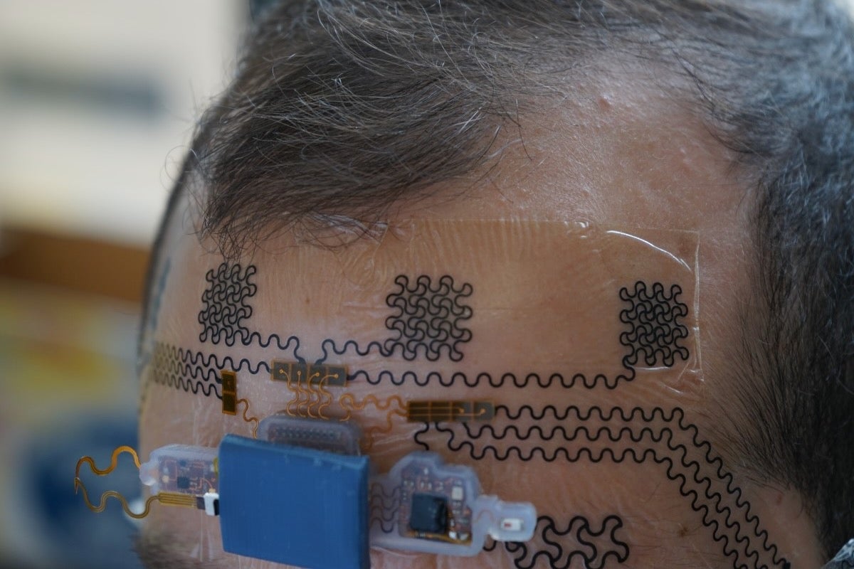 A person with wireless forehead e-Tattoo