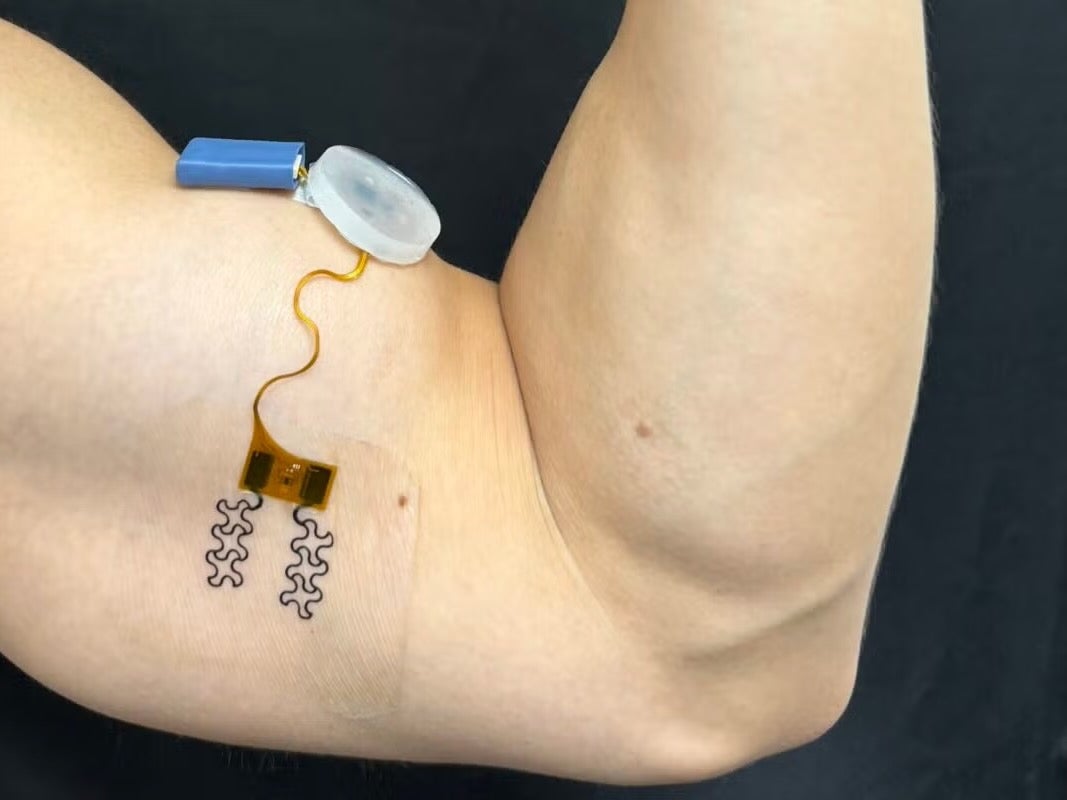 arm with a wearable sensor