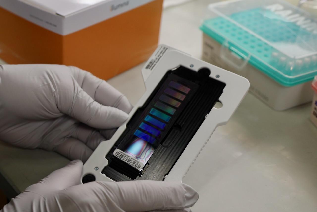 EPIC Methylation Array