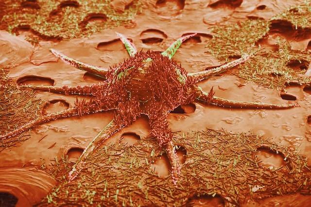 dead cell