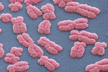 A colorized scanning electron micrograph of human chromosomes, colored pink, on a blue-gray surface.
