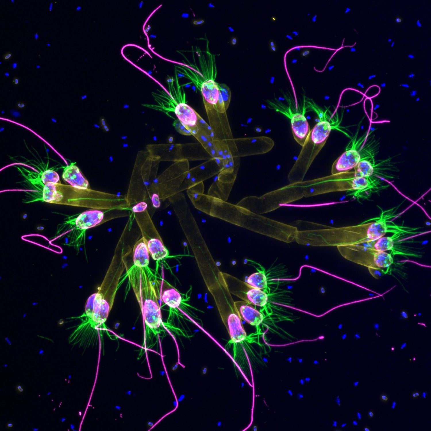 Super-resolution microscopy of Choanoflagellates