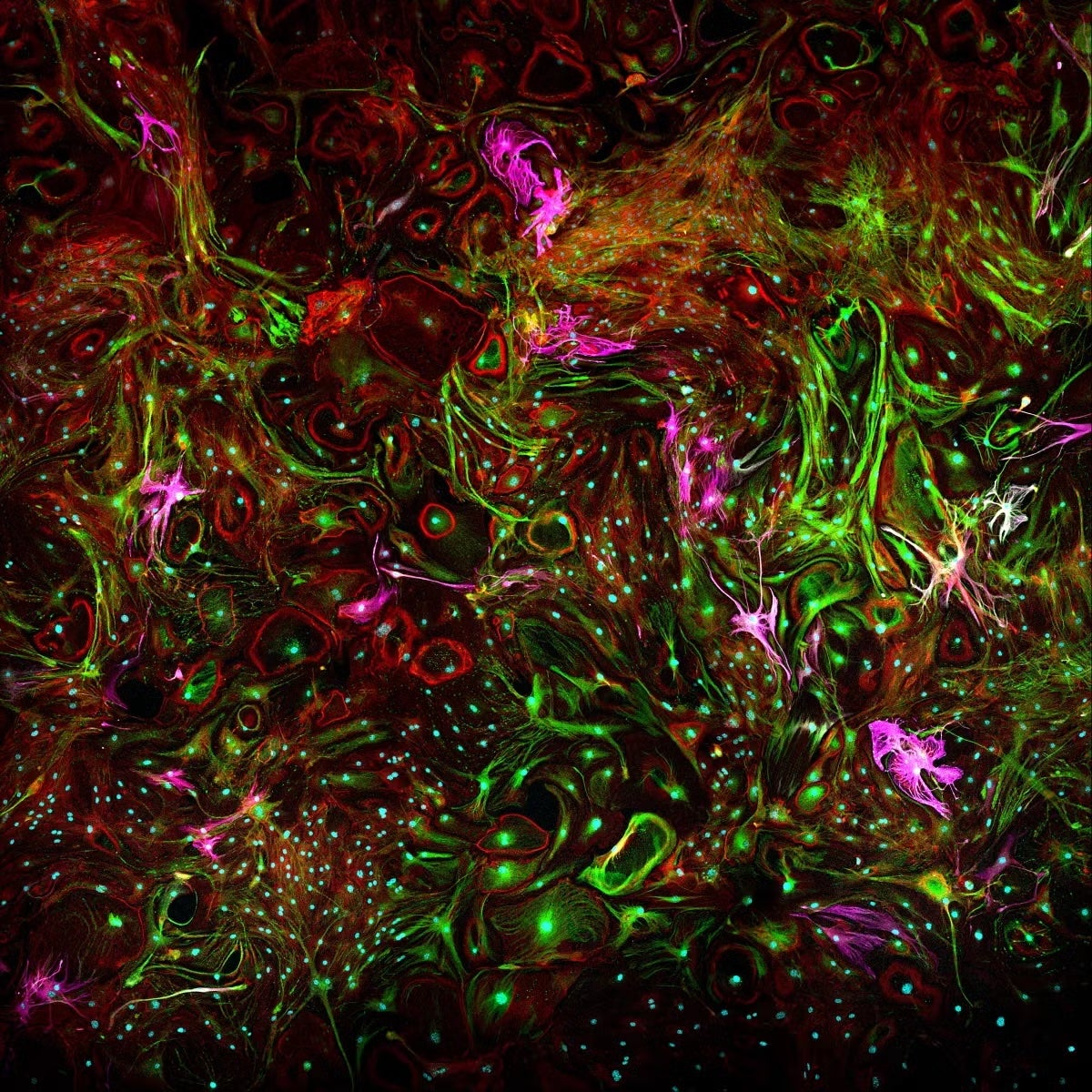 Confocal microscopy of astrocytes